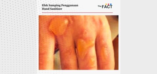 Efek samping penggunaan hand sanitizer